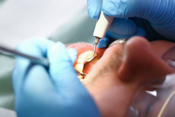 Best Emergency Dental Extractions in Arlington Heights, PA